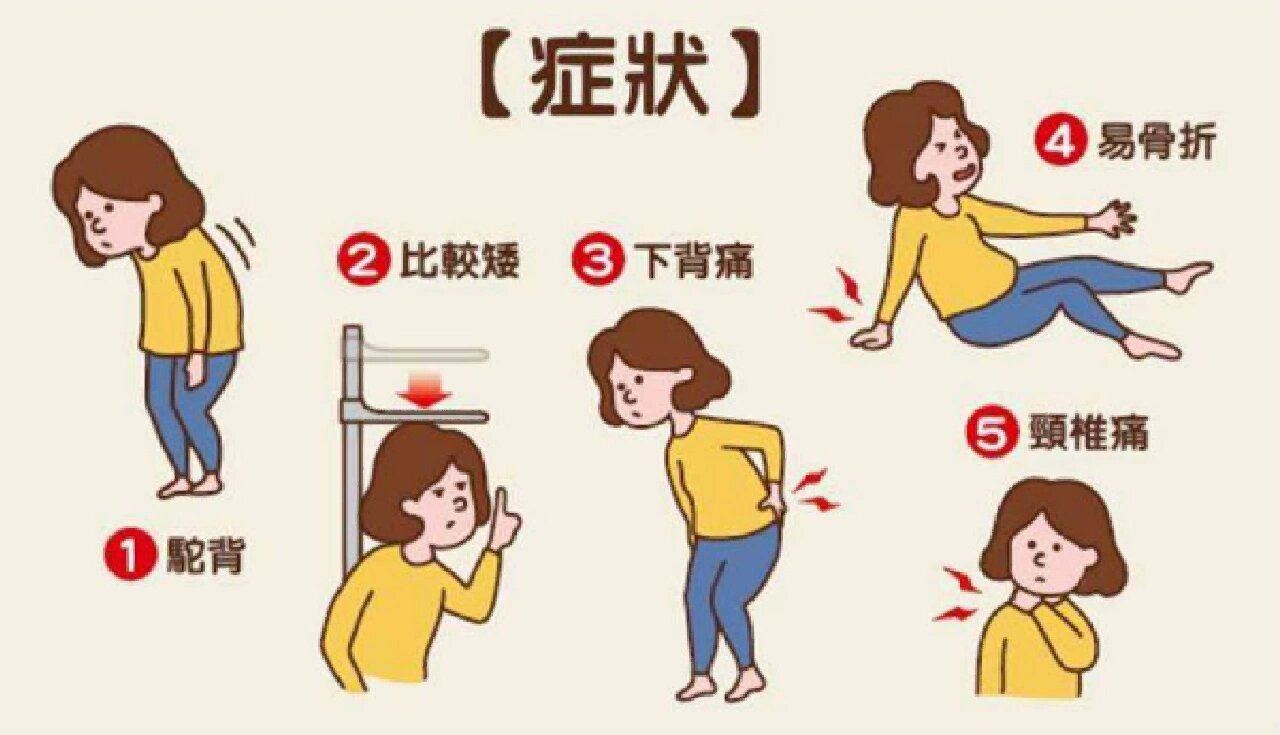 骨骼的 “健康悄悄话”，双能 X 射线骨密度仪帮你 “听清楚”！