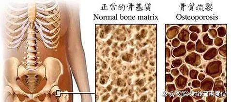 探究骨骼的秘密：从结构功能到健康守护