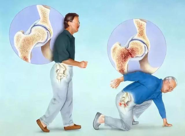 探究骨骼的秘密：从结构功能到健康守护