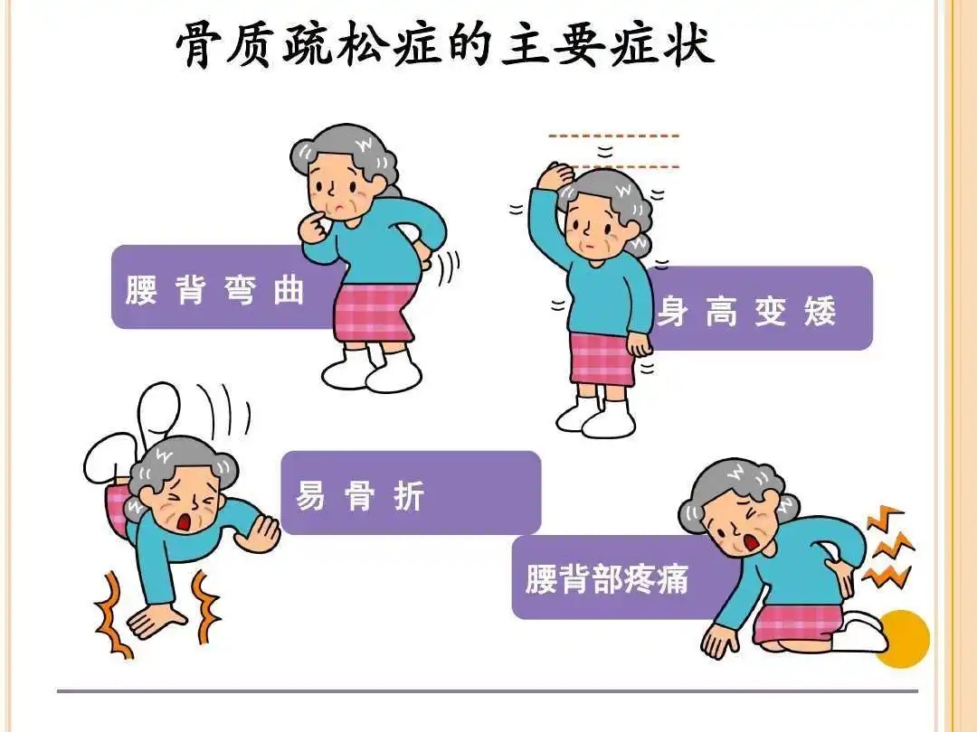 骨骼健康“成绩单”：解读骨密度仪测量数据，看清你的生命支撑根基